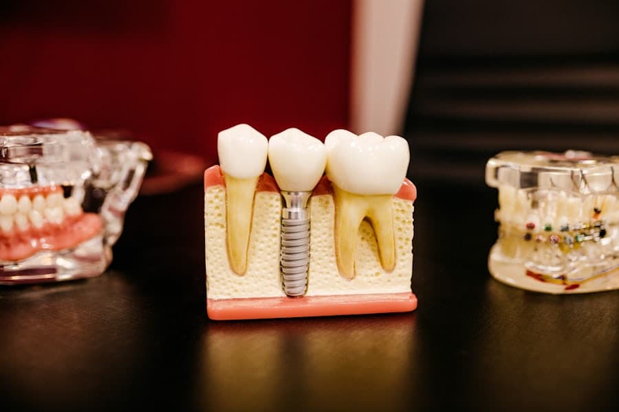 A dentist showing a ceramic dental veneer model to a patient