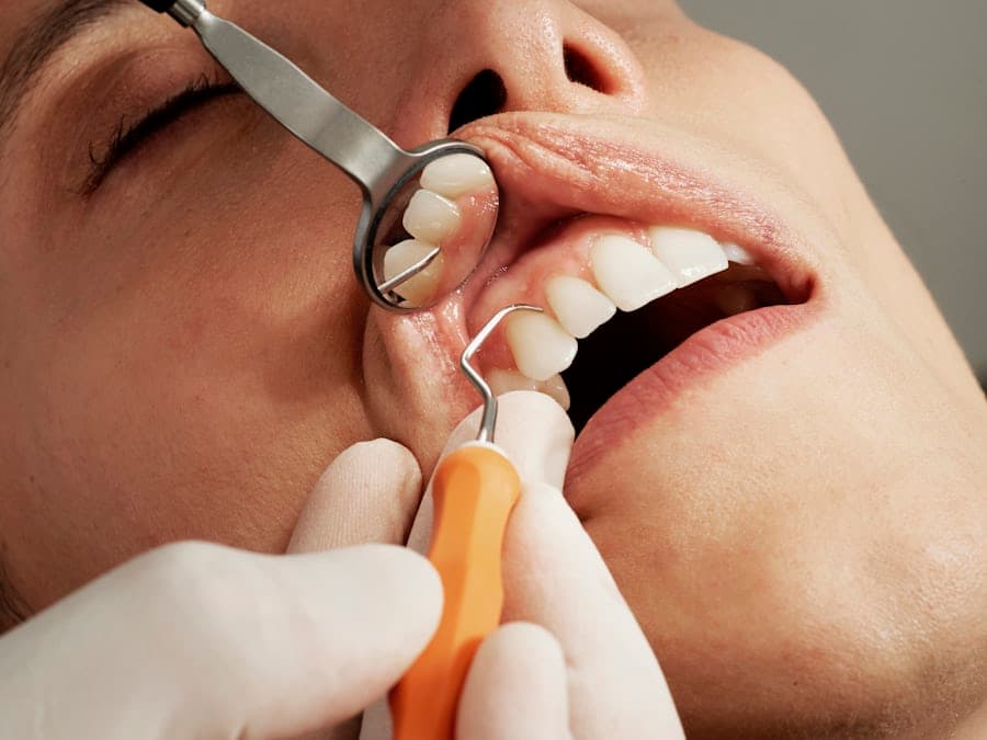 Dental hygienist performing a cleaning using high-tech tools